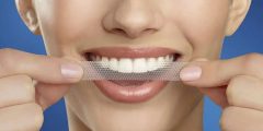 ما هي لصقات تبييض الأسنان وكيفية استخدامها