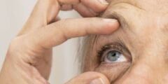 العلاج الطبيعي لتآكل ماقولة العين (شبكية العين)