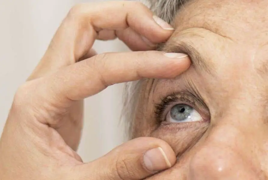 العلاج الطبيعي لتآكل ماقولة العين (شبكية العين)